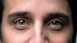 Estos son los 5 factores clave que provocan que te salgan ojeras, según el doctor Ruiz
