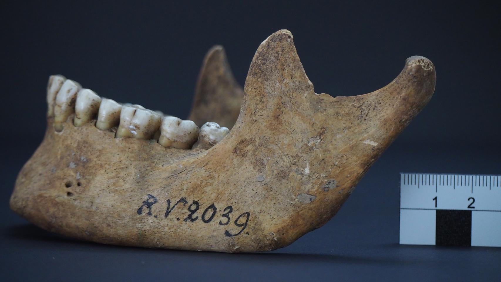 Mandíbula del hombre enterrado Riņņukalns hace unos 5.000 años.