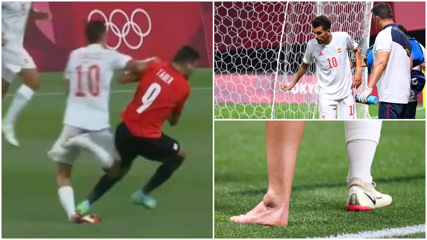 La fea lesión de Ceballos