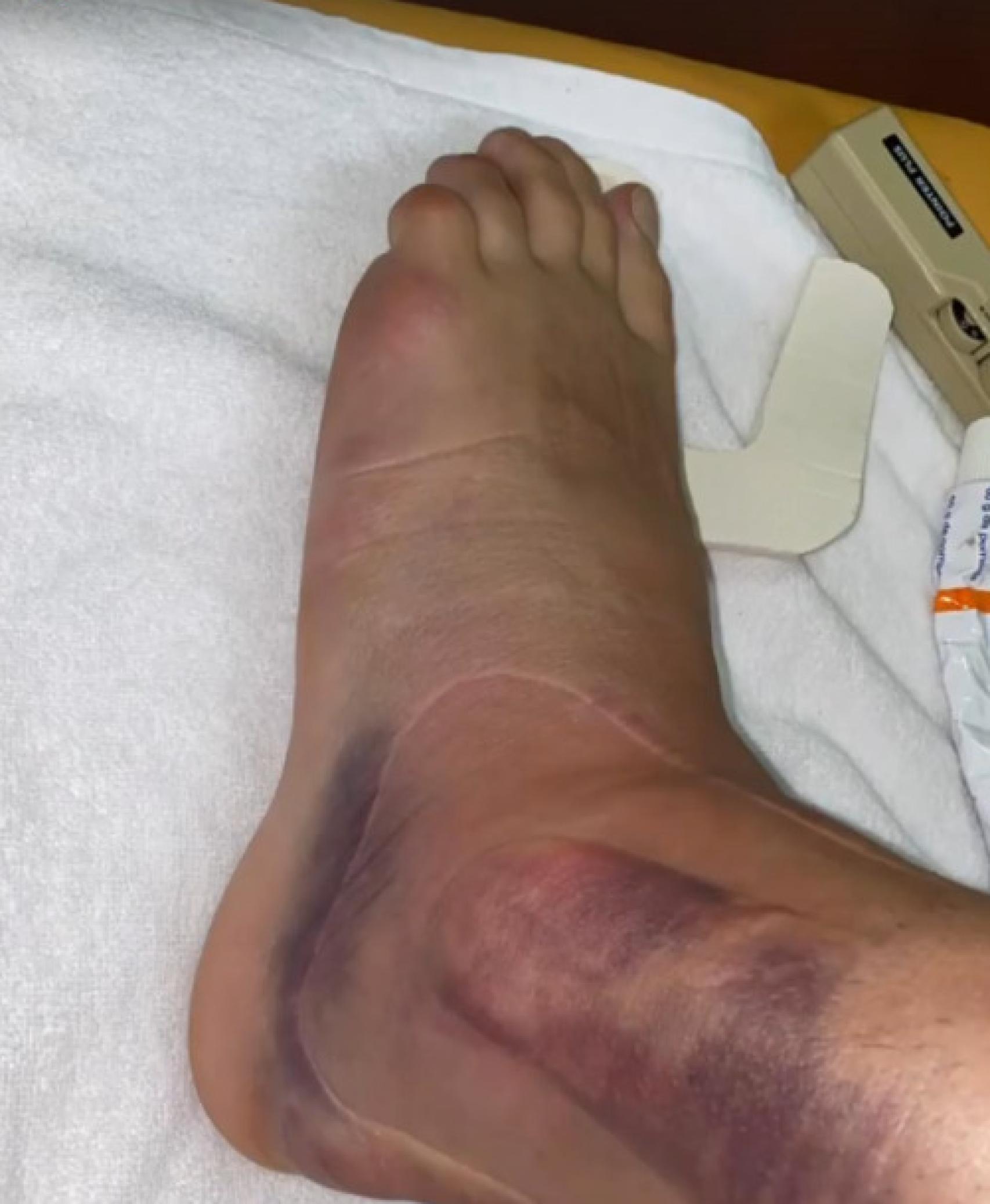 La lesión de Ceballos