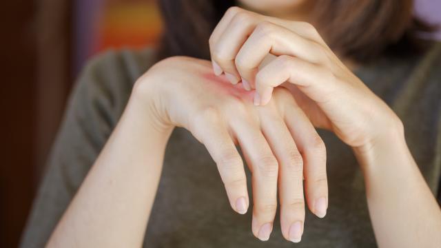 Este es el mejor dispositivo para lidiar con las picaduras de mosquitos