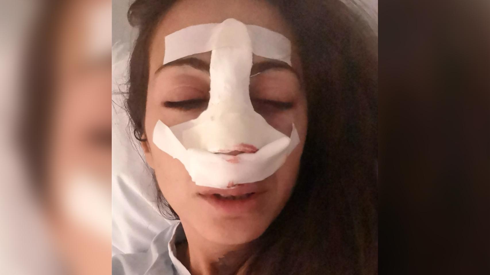 Noa, víctima de una brutal paliza por defender a un perro.