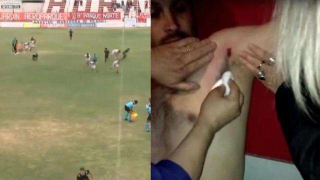 Un fotomontaje del momento del tiroteo y de la herida de Mauricio Romero