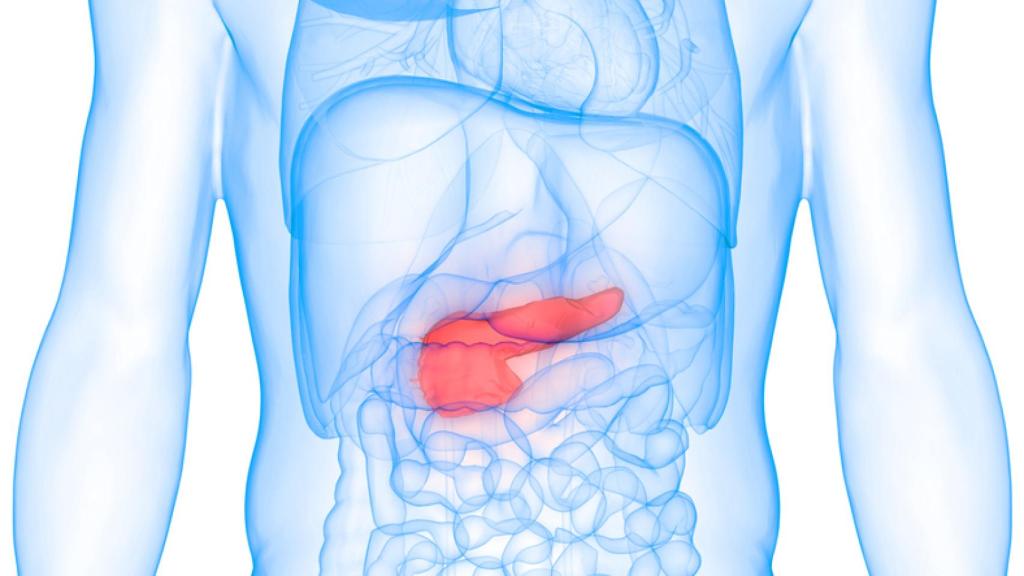 Cáncer de páncreas