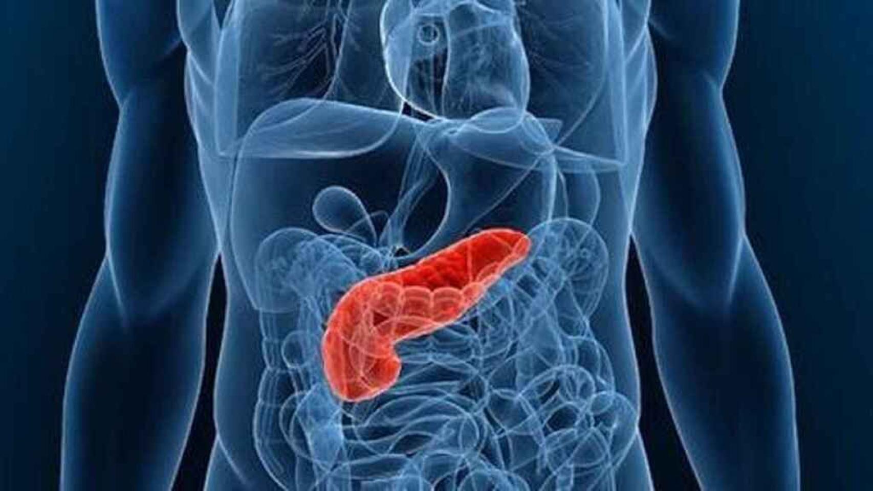 El diagnóstico tardío es una de las causas de la alta tasa de mortalidad en este tumor.