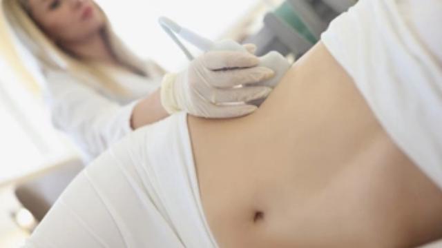 A una mujer le hacen una ecografía de riñón.