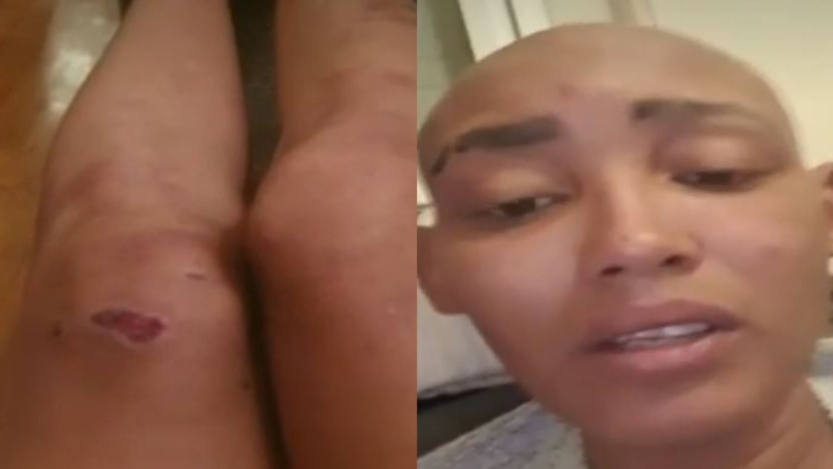 Elayne, la joven agredida, en su aparición en 'Espejo público'.