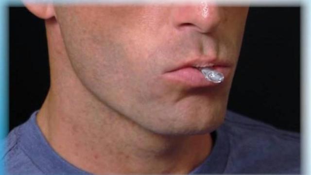 Dispositivo dental contra los ronquidos.