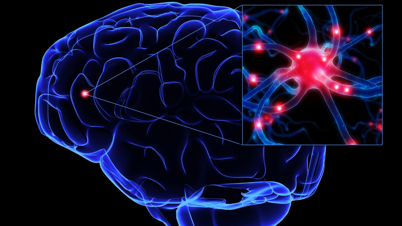 Neuroestimulación.