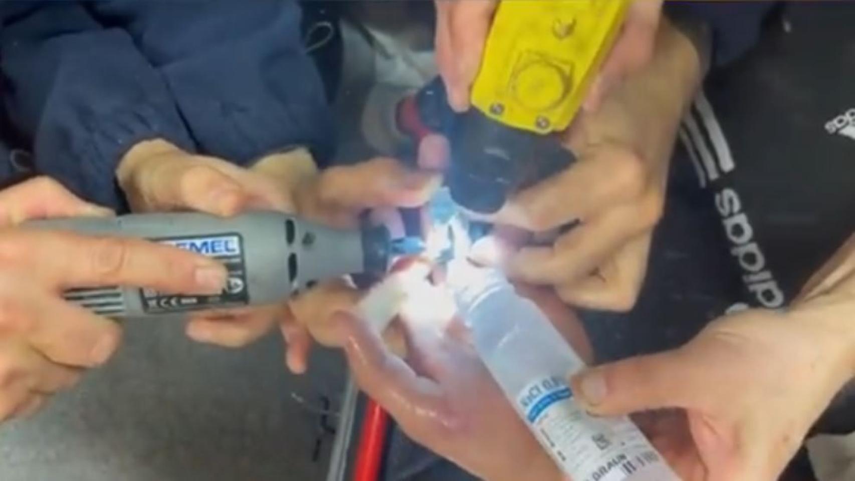 Los bomberos de Tomelloso quitando el anillo atascado en el dedo de un adolescente.