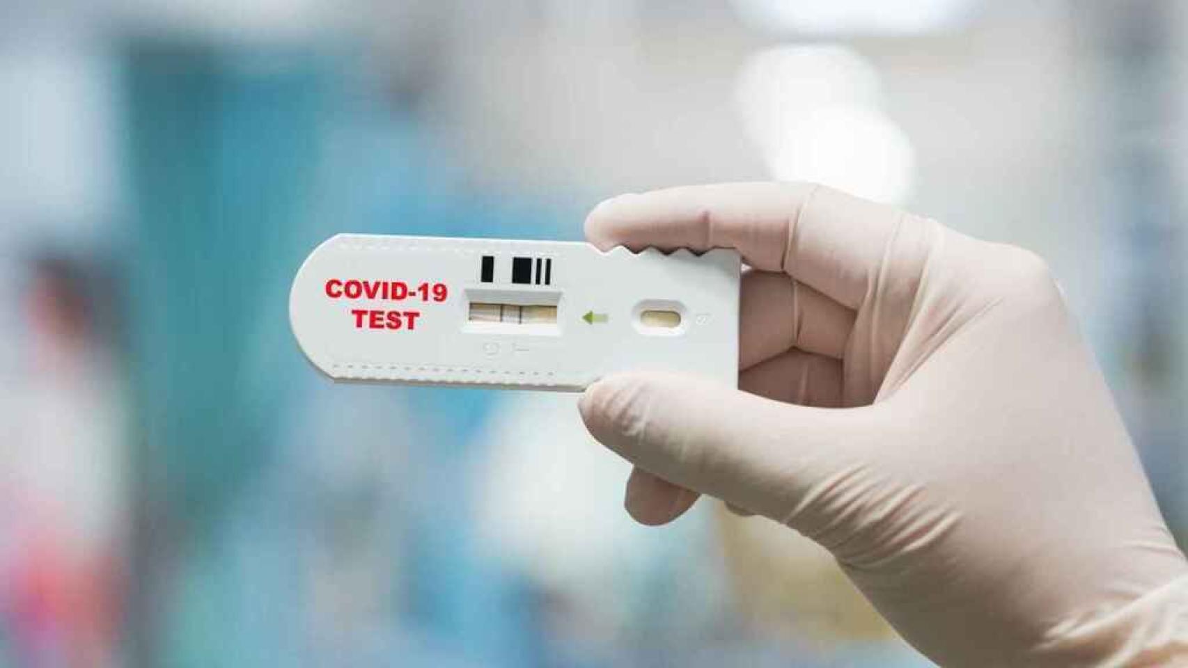 Test de antígenos.