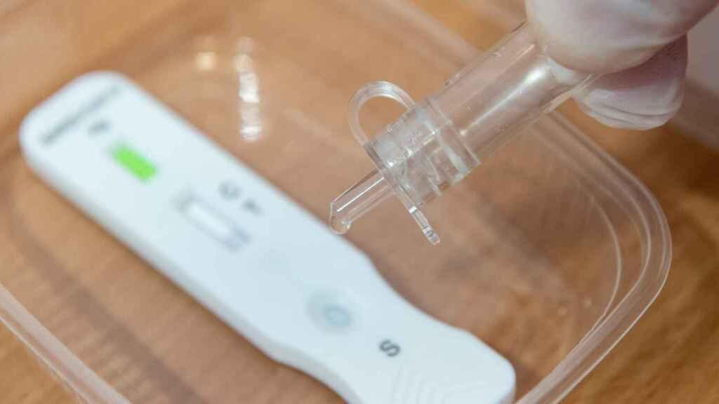 Imagen de archivo de una prueba con test de antígenos.