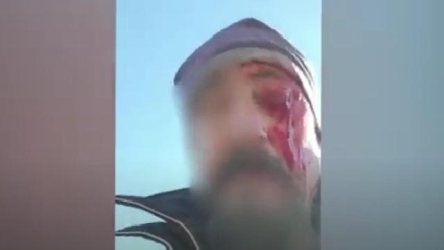 Pierde un ojo en Toledo al ser agredido por dos cazadores que disparaban junto a las viviendas