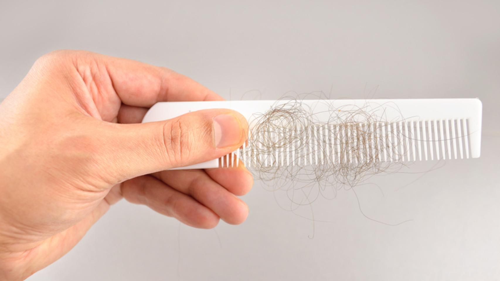 Tratamiento para recuperar el cabello perdido.