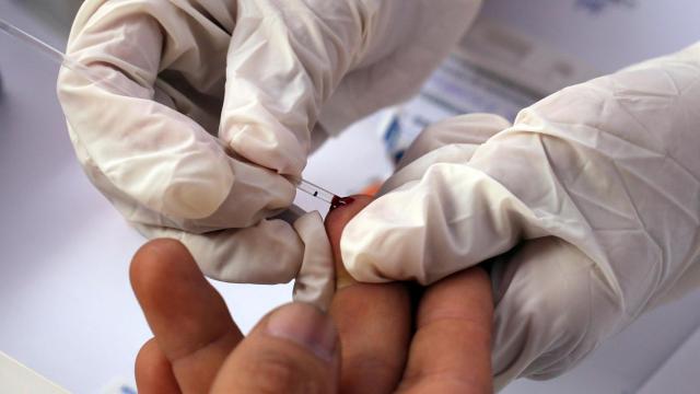 Prueba de detección de VIH.