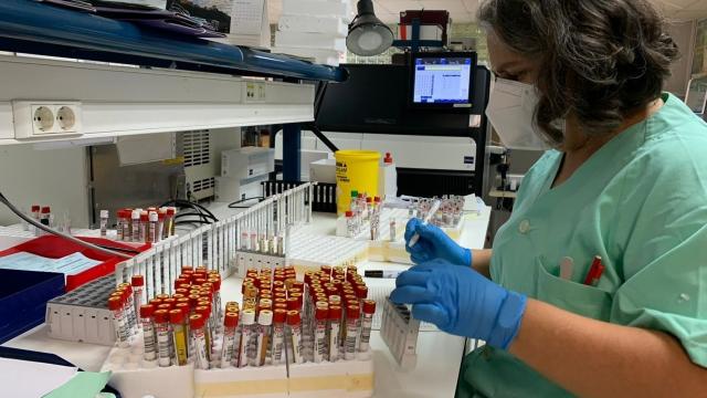 Detección precoz del VIH. EP.