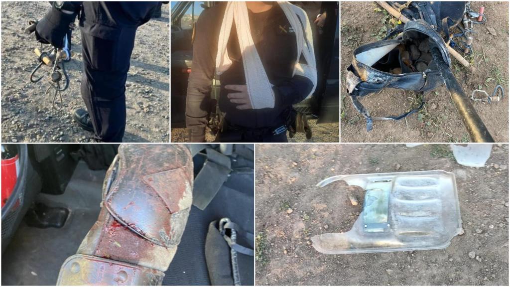 Algunas de las heridas y lesiones de los agentes tras los saltos en Melilla.