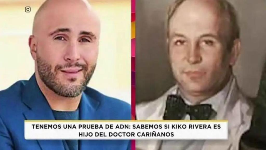 Kiko Rivera en una comparativa junto al doctor Cariñanos en el programa 'Socialité'.