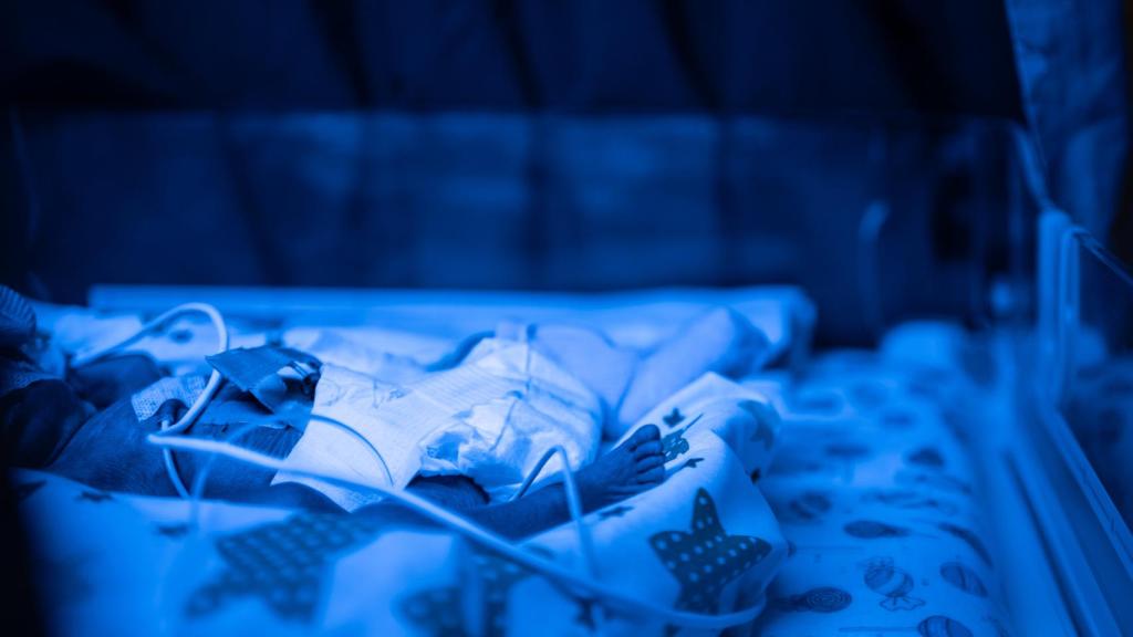 Un bebe de 24 semanas duerme en la Unidad de Cuidados Intensivos del Hospital regional materno de Odesa.