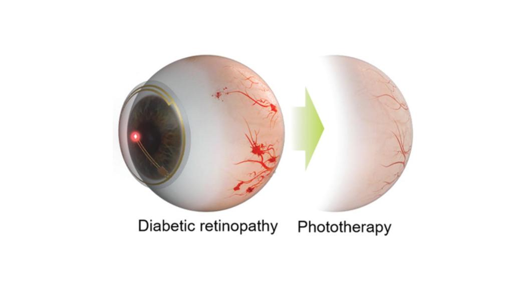 Las lentillas inteligentes LED ya se han probado en conejos.
