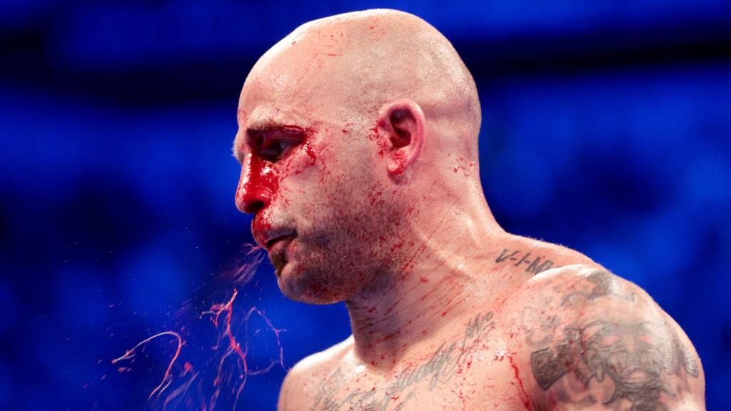 El boxeador español Kiko Martínez, 'La Sensación'