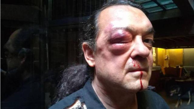 Brutal agresión en 2017 al toledano Fernando Barredo, líder de la corriente crítica Imagina Podemos
