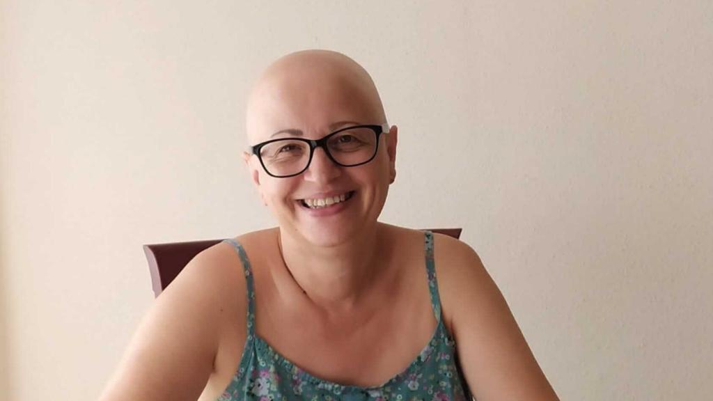 Teresa sufre alopecia desde niña.