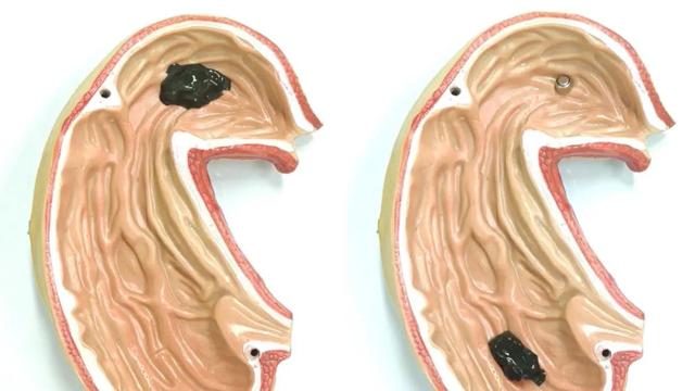 Robot en una imitación de un sistema digestivo.