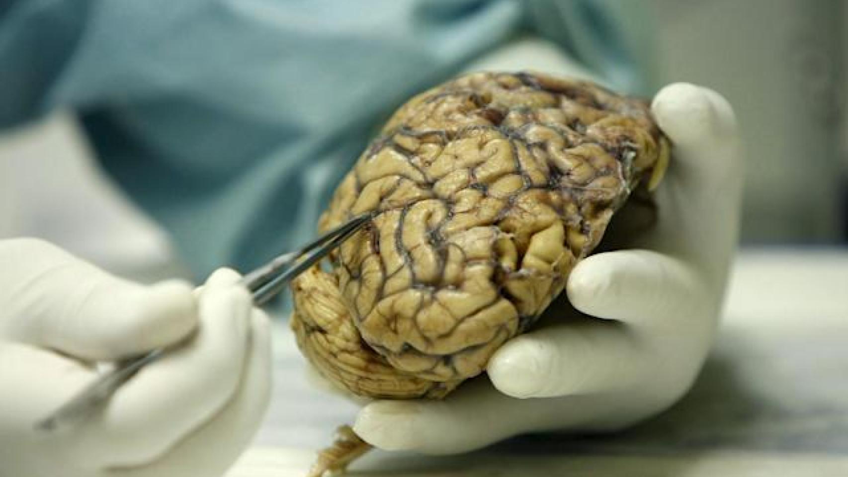 Un investigador manipula la maqueta de un cerebro.