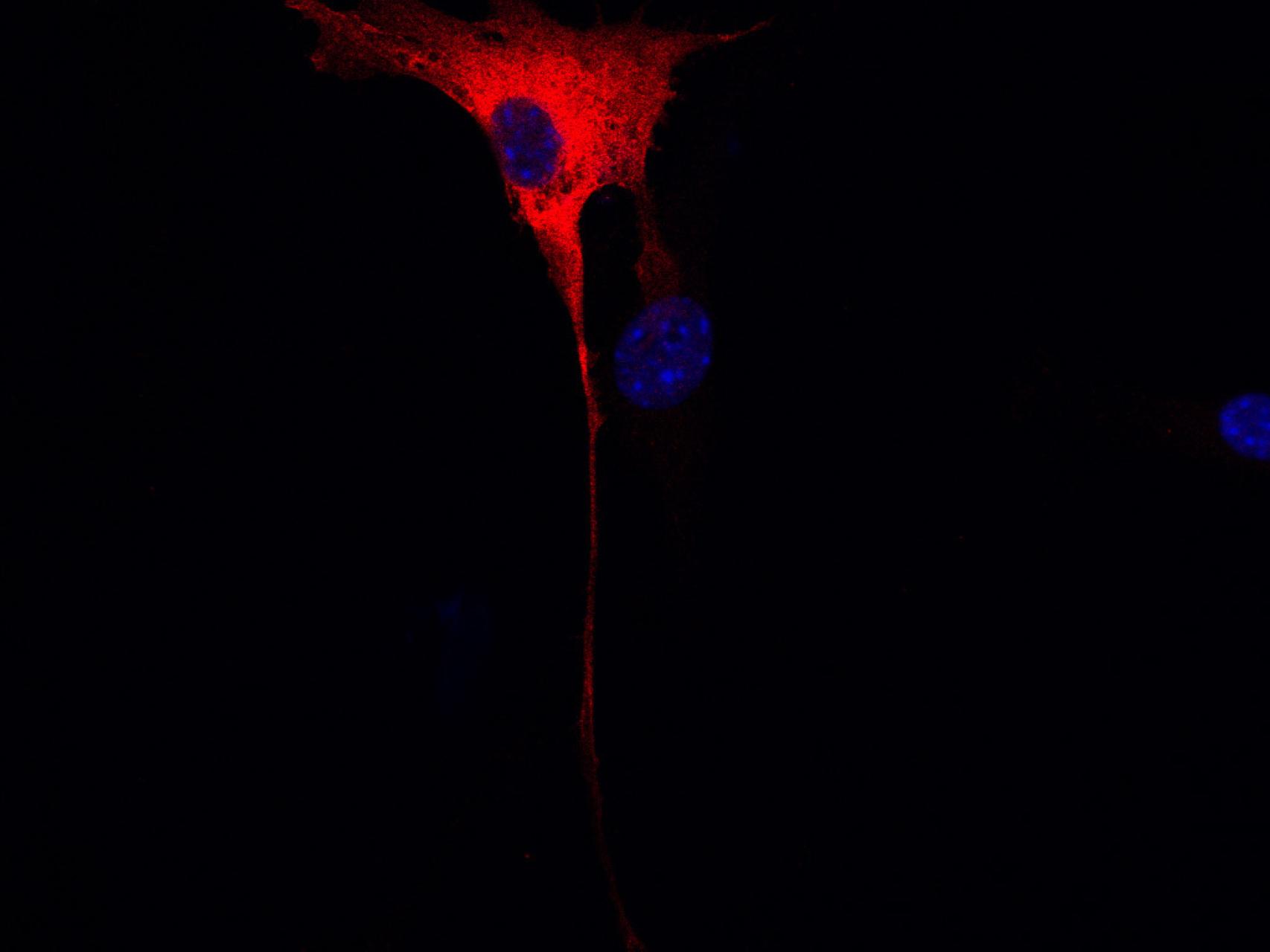 Célula que presenta altos niveles de KSR (en rojo)