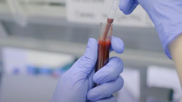 Imagen de archivo de una probeta con sangre.