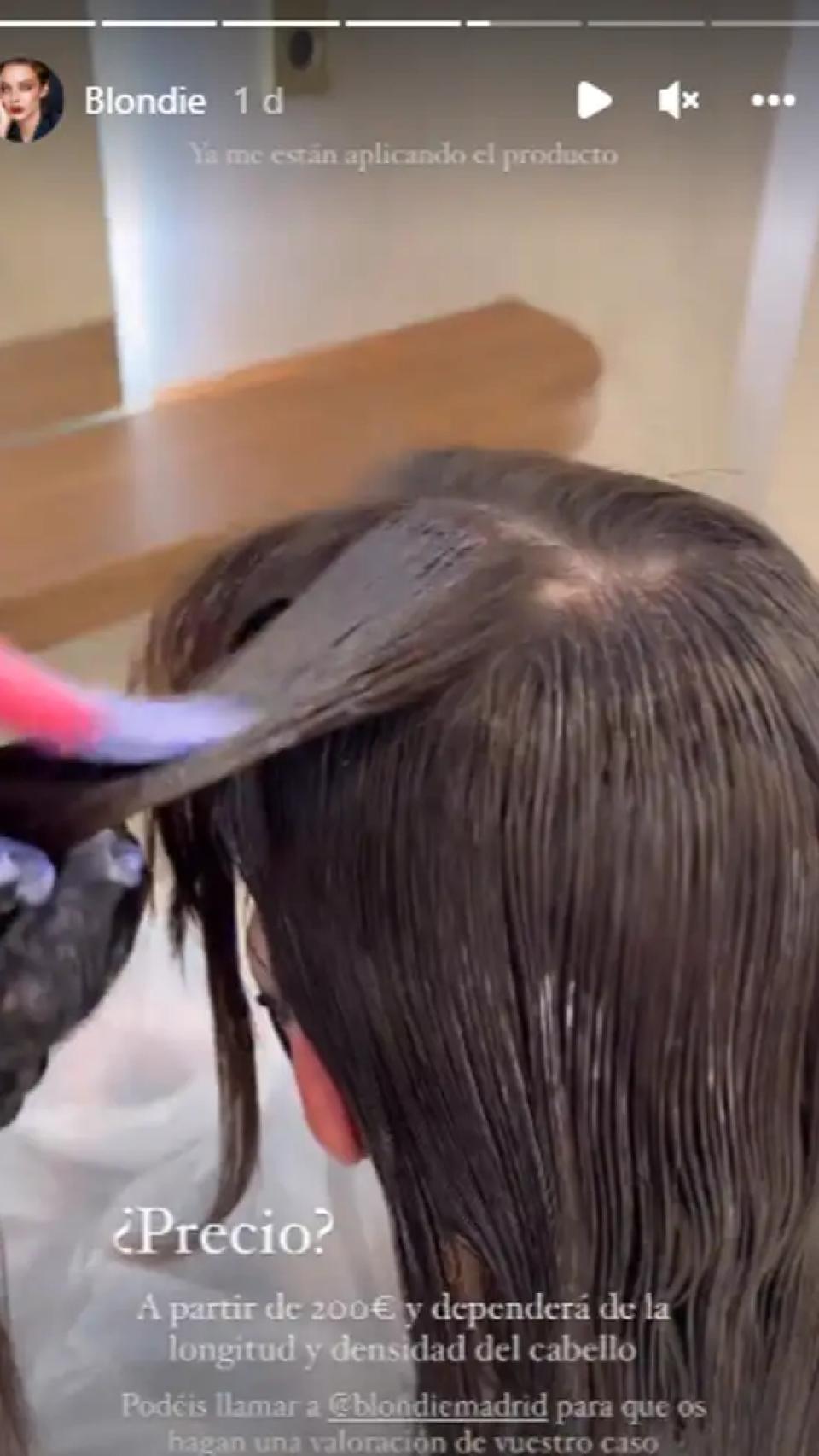 Imagen en la que se aprecia la alopecia de Laura Escanes.
