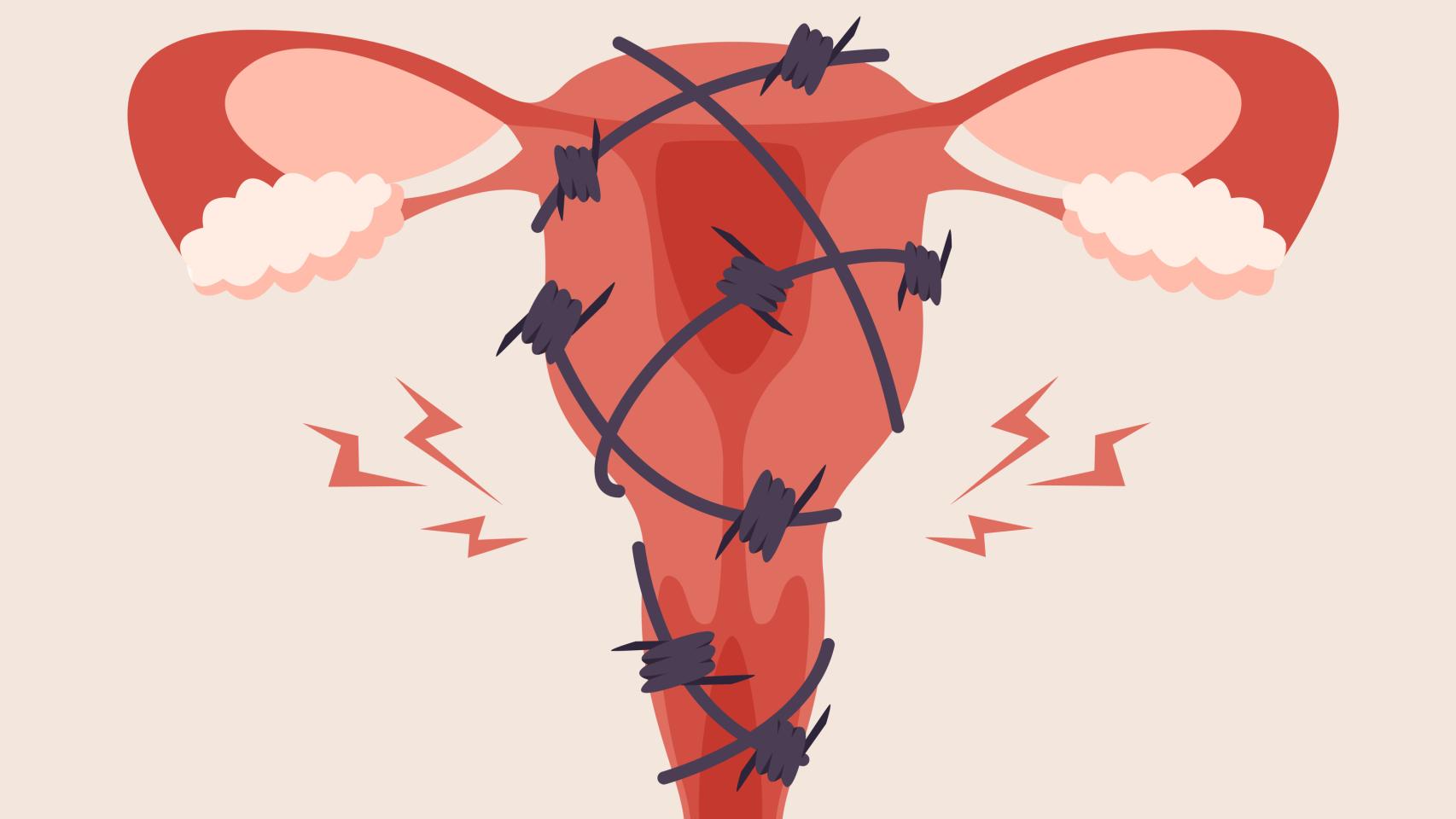 En la actualidad, no hay una forma objetiva de medir el dolor menstrual.