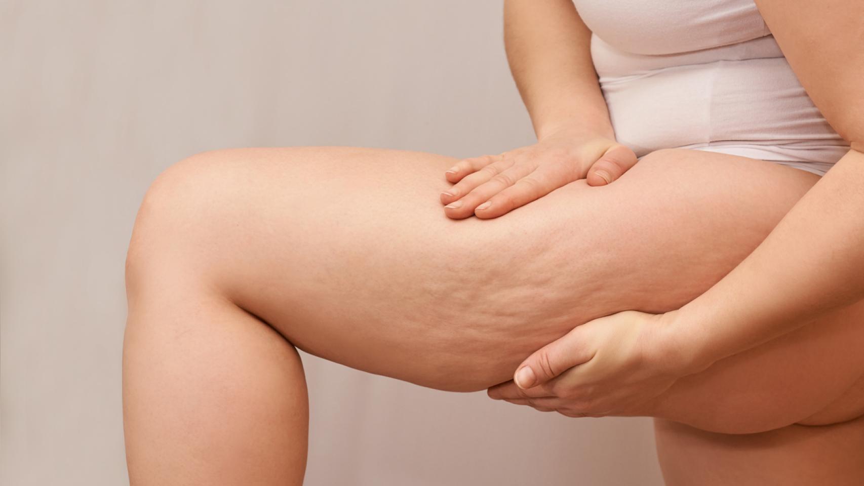 Los nuevos productos incluyen activos más potentes contra la celulitis.