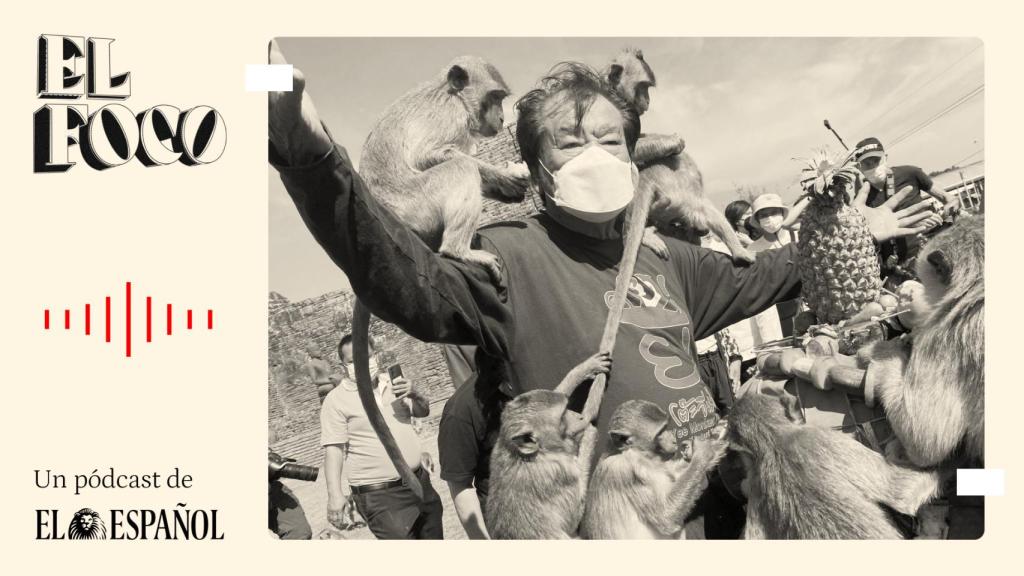 La viruela del mono no será la última