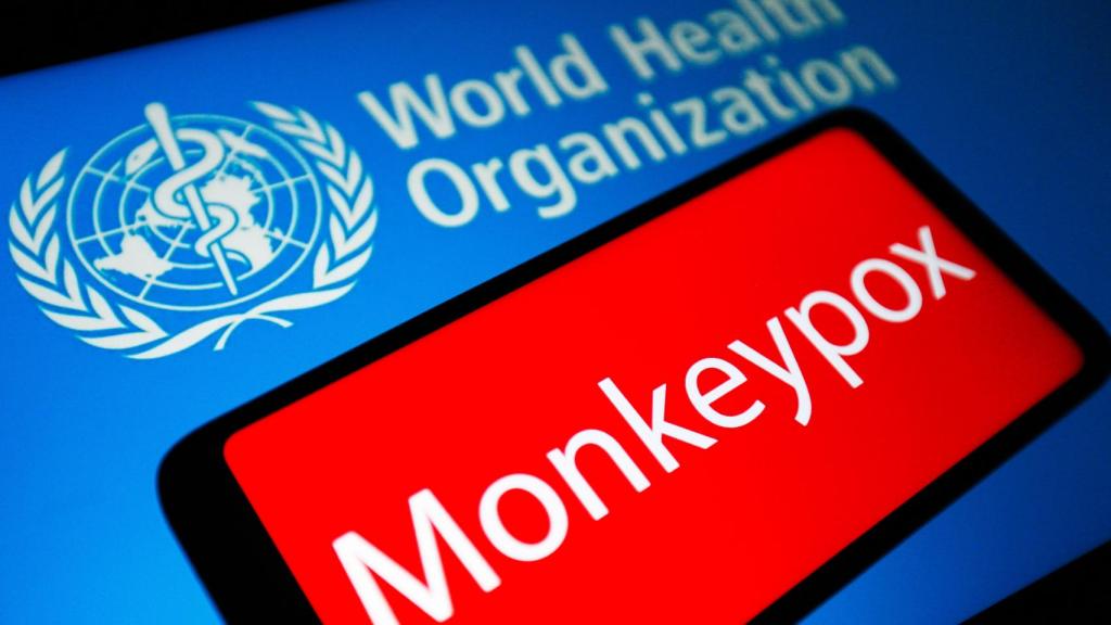 La OMS alerta sobre la viruela del mono.