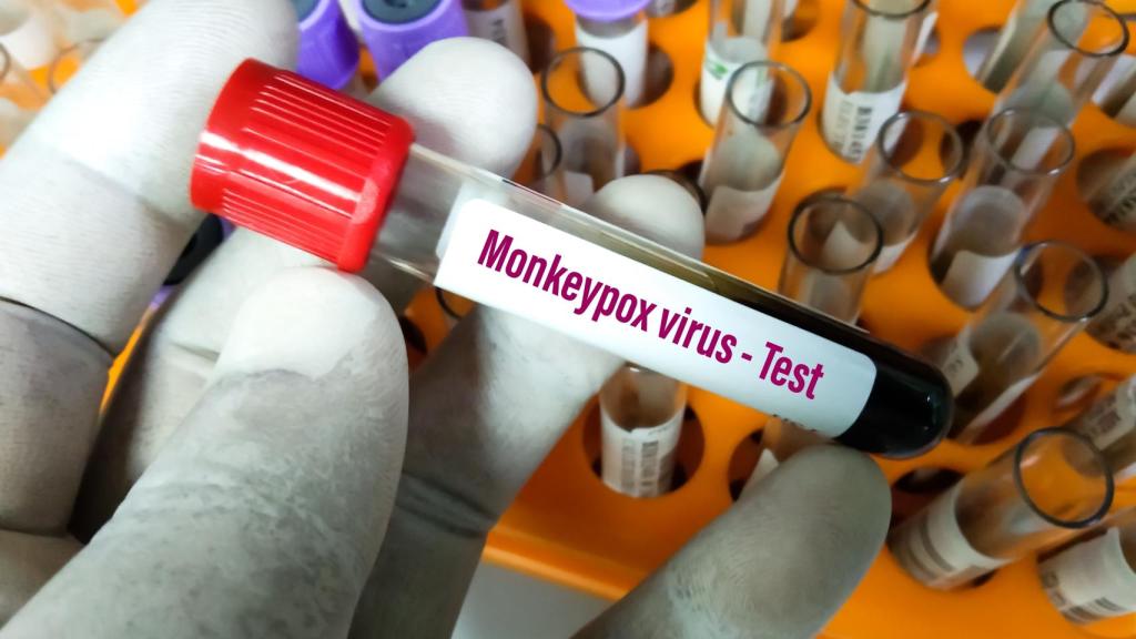 Imagen de archivo de un test de la viruela del mono.