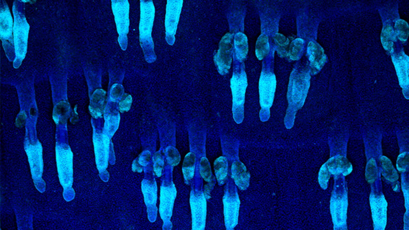 Oncogenes