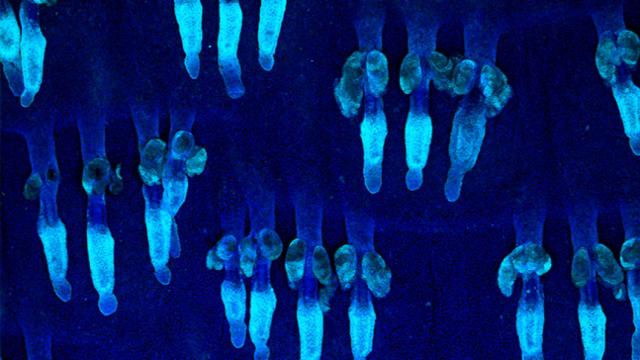 Oncogenes
