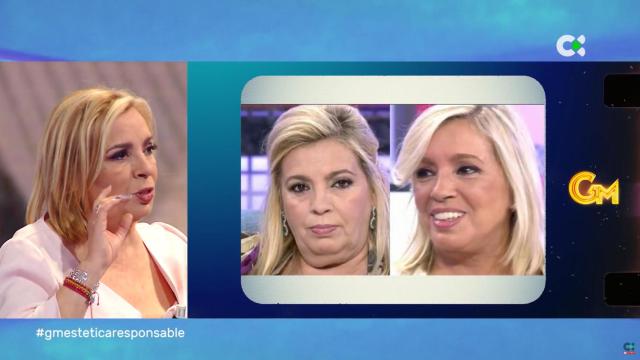 Carmen Borrego: Ahora soy más feliz gracias a la cirugía estética y al psicólogo