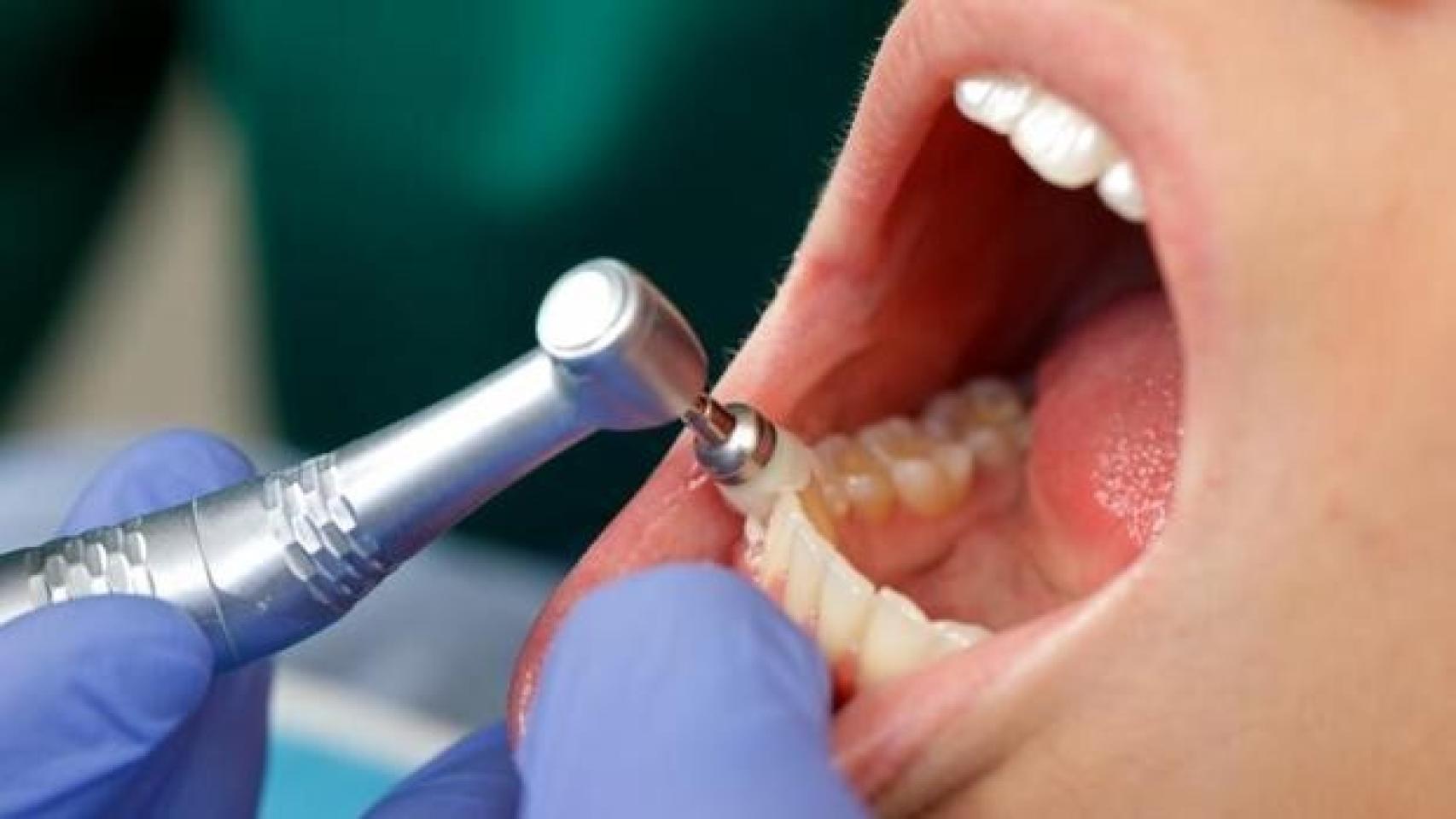 Una persona se somete a una revisión en el dentista.