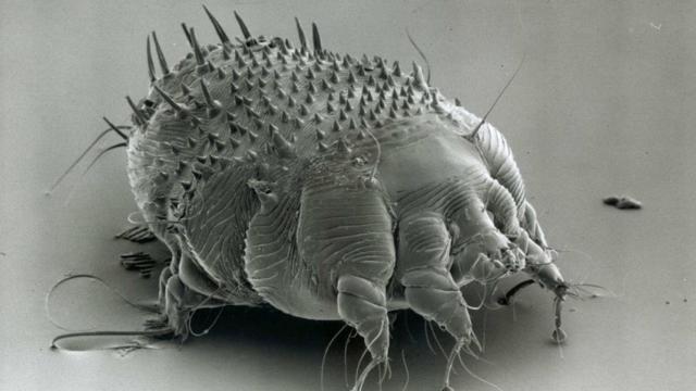 El ácaro que provoca la sarna en humanos, el 'sarcoptes scabiei'.