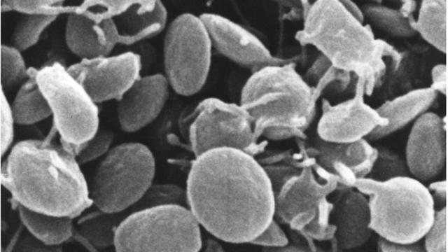 Plaquetas de la sangre vistas en el microscopio.