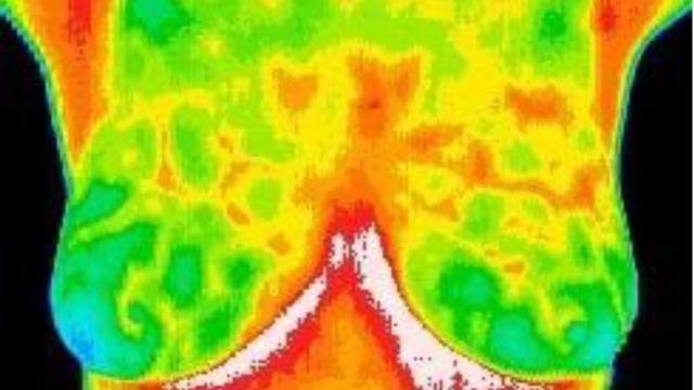 El resultado de la termografía con IA.