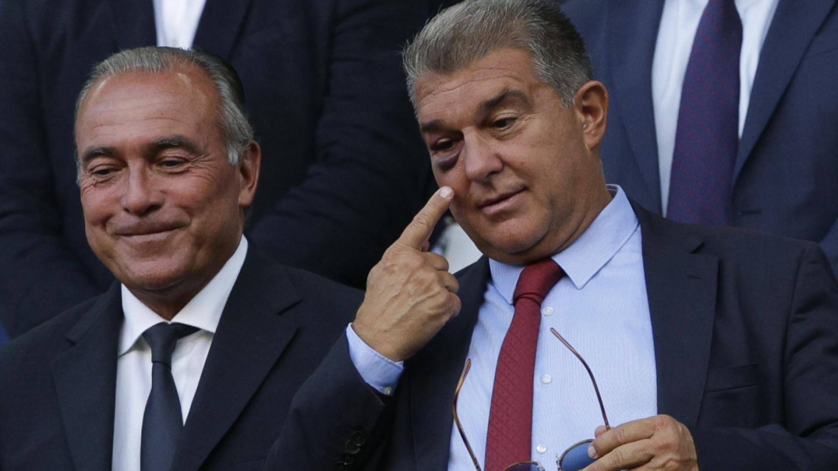 Joan Laporta muestra su ojo morado en el palco del Camp Nou