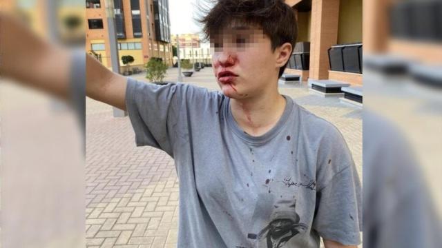 La foto publicada por la menor en redes sociales tras la agresión.