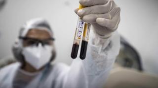 Una investigación consigue detectar el cáncer de manera precoz con un análisis de sangre.