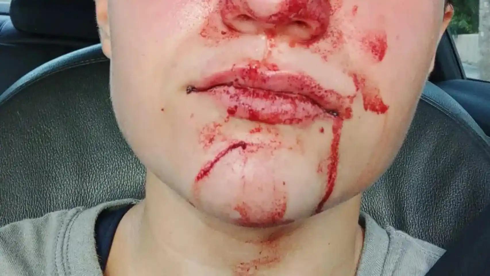 La menor de 15 años publicó esta y otras imágenes de la supuesta agresión en sus redes sociales.