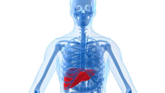 Inflamación del higado.