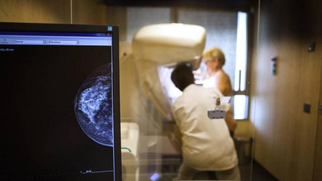 El cáncer en personas relativamente jóvenes ha aumentado más allá de los diagnósticos de los cribados.